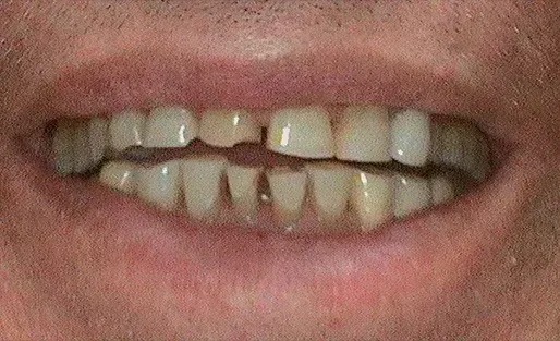 Before